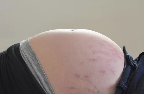 10 Cách Sử Dụng Bio-Oil Tốt Nhất 2 R N Da B B U Jpg